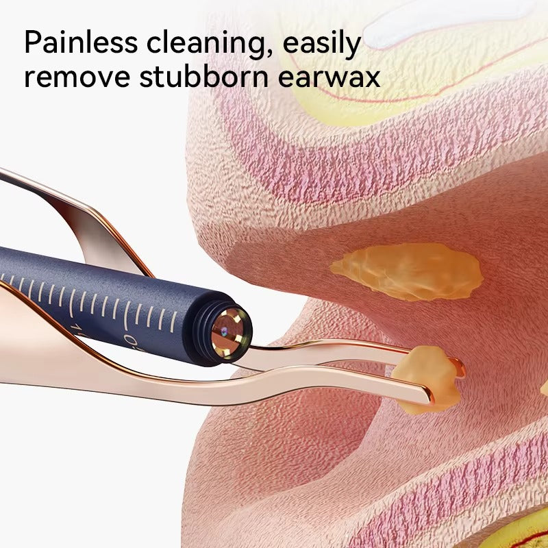 EveryEar Vision Ultra Ear Wax Cleaner – 1080P HD Endoscope Kit